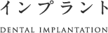 インプラント dental implantation